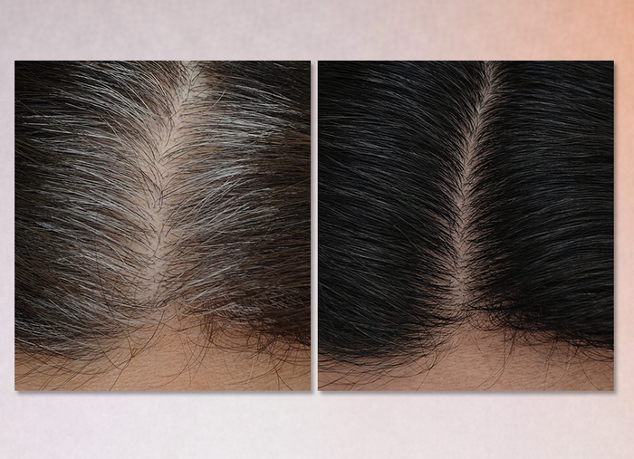 Before and after transformation