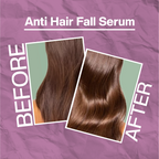Anti Hair Fall Serum 115ml – Reduces Breakage Related Hair Fall