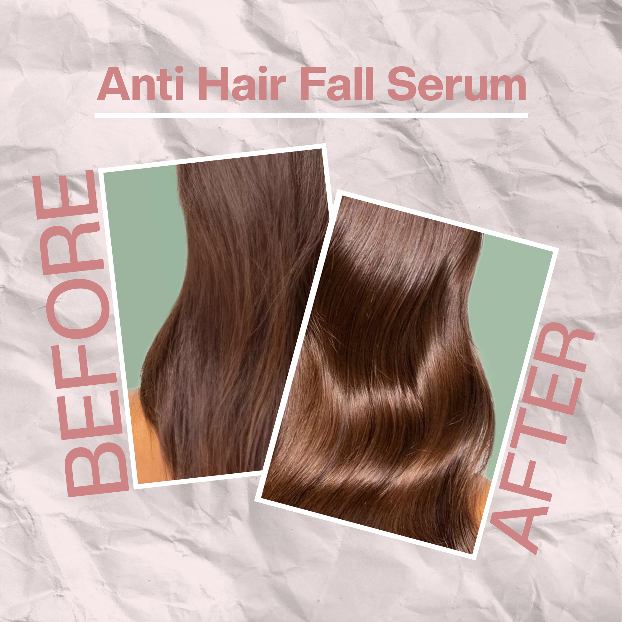 PROADS Anti Hair Fall Serum 115ml – Reduces Breakage Related Hair Fall