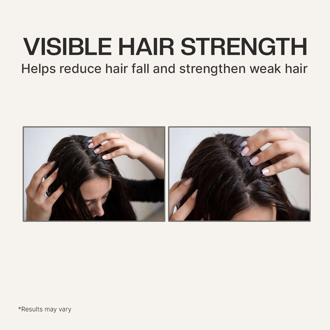 Hair Defence Shampoo 300 ML for Dandruff & Itchy Scalp